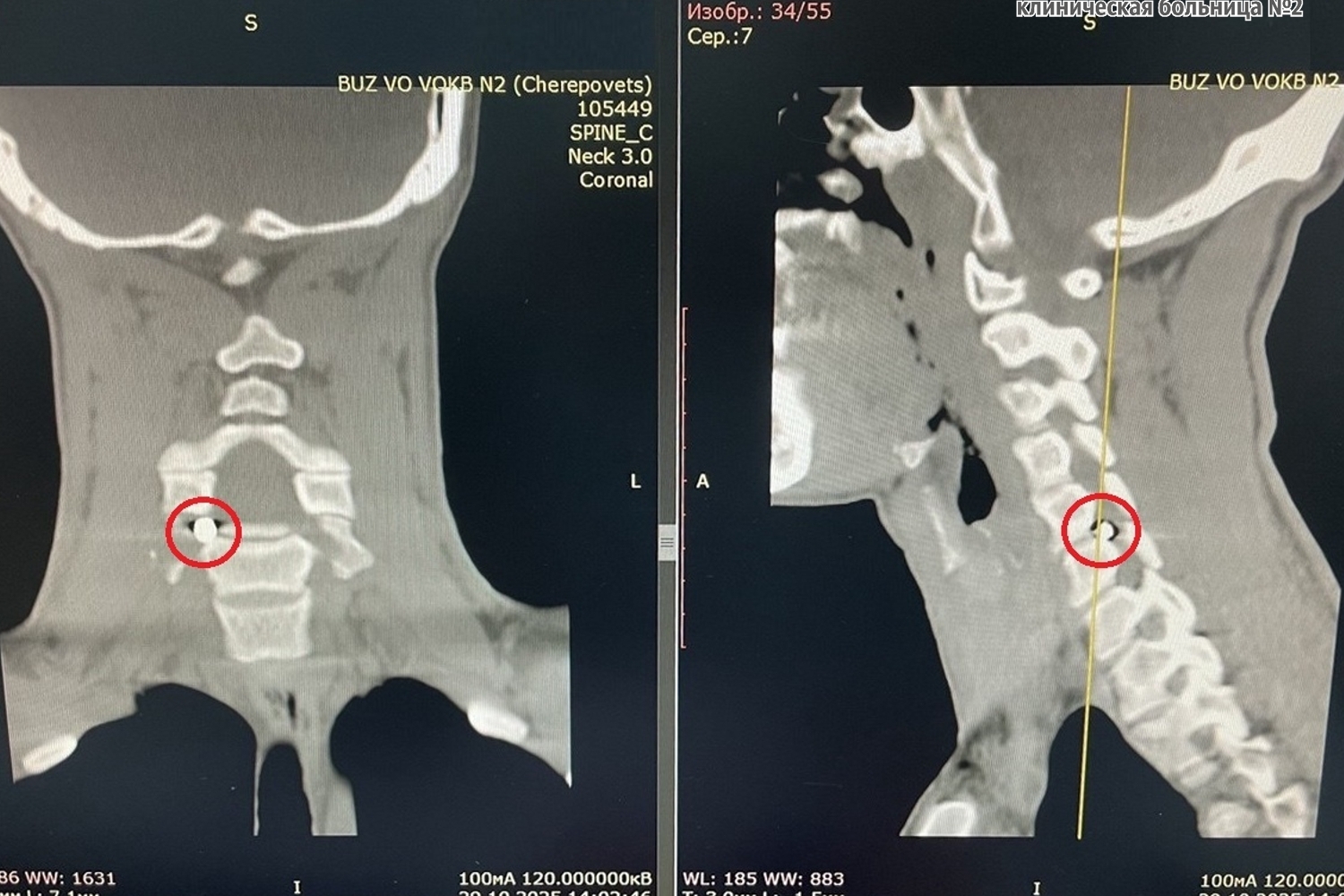 Фото: облбольница №2 Новости Черинфо